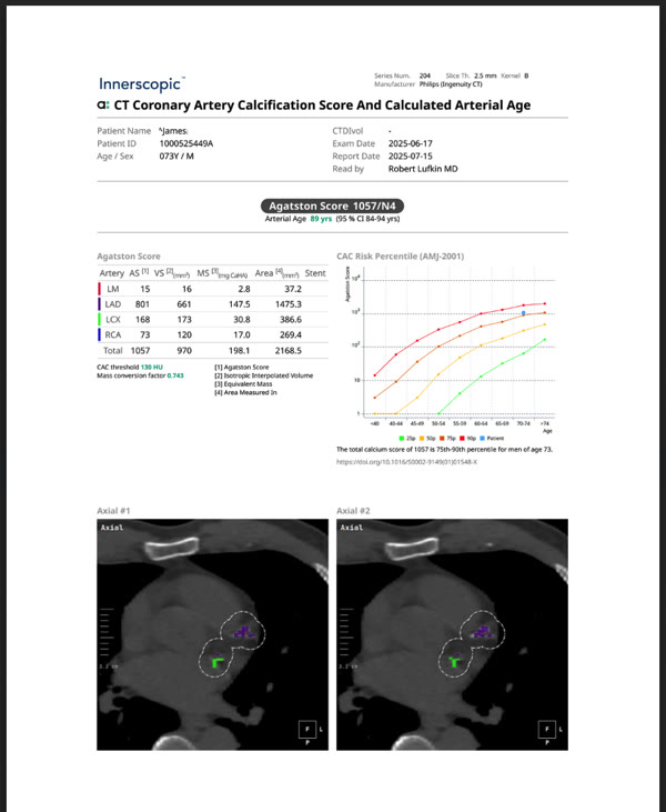 Innerscopic Complete Metabolic Heart Scan